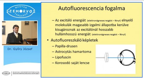 A szemfenéki kékeszöld autofluorescencia...