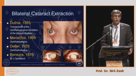 Szimultán bilaterális cataracta extractio