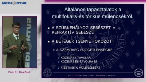Általános tapasztalatok a multifokális és tórikus műlencsékről