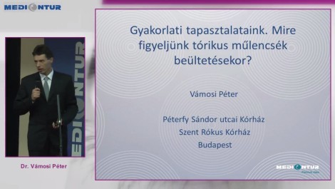 Gyakorlati tapasztalataink. Mire figyeljünk tórikus műlencsék beültetésekor?