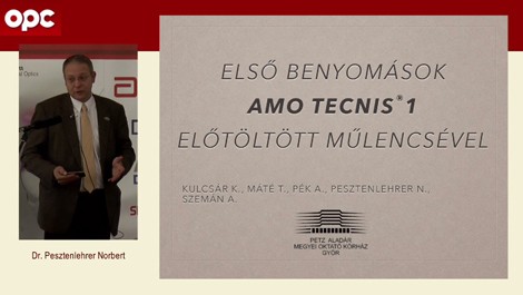 Benyomások a Tecnis1 előretöltött lencsével kapcsolatban