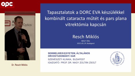 Tapasztalatok a DORC „EVA”  készülékkel kombinált szürkehályog és pars plana vitrectómia során