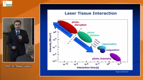 Femtoszekundum lézer használata a keratoplasztikák során