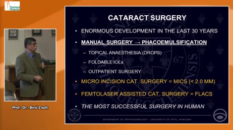 Femtocataracta és MICS